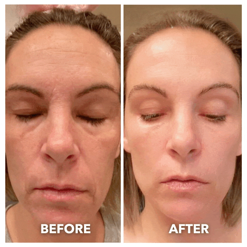 Aurenza Shop 7-in-1 LED facial toning and rejuvenation wand with multiple attachment heads for skincare treatment.