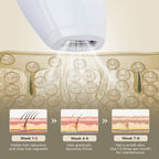 Aurenza Shop IPL hair removal device with sleek design, featuring treatment window and control buttons for at-home hair removal.