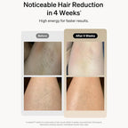 Aurenza Shop IPL hair removal device with sleek design and control panel, ideal for at-home hair removal treatments.