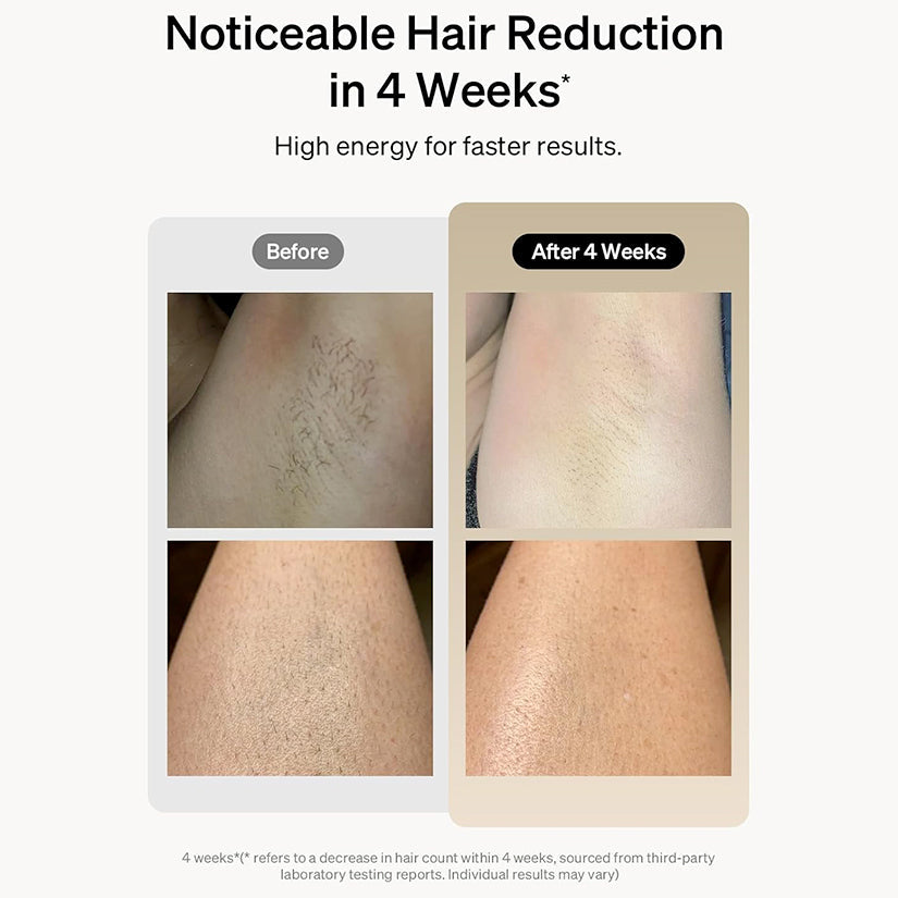 Aurenza Shop IPL hair removal device with sleek design and control panel, ideal for at-home hair removal treatments.