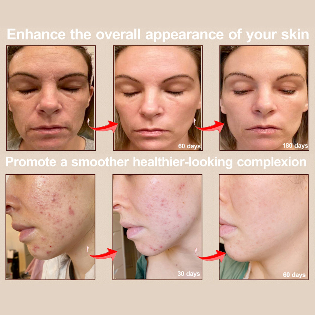 Aurenza Shop Face Mask Light Therapy Pro showcasing a sleek, modern facial mask with adjustable straps and LED light panels.