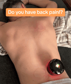 Aurenza 4-in-1 Smart Cupping Therapy Massager with red light therapy, showing adjustable cups and control panel in action.
