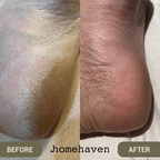 Aurenza SpaSculpt Pro Pedicure & Callus Remover device with a sleek design and textured grip for effective foot care.