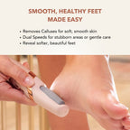 Aurenza SpaSculpt Pro Pedicure & Callus Remover wand with a sleek design, ideal for smooth, polished feet and callus removal.