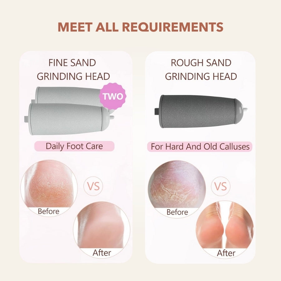 Aurenza SpaSculpt Pro Pedicure & Callus Remover wand with a sleek design for smooth, professional-looking foot care.