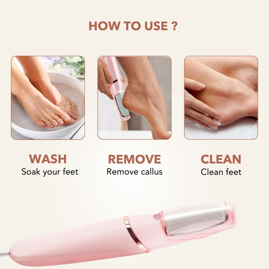 Aurenza SpaSculpt Pro Pedicure & Callus Remover wand with a sleek design, ideal for smoothing and removing calluses from feet.