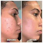 Aurenza Shop Face Mask Light Therapy Gen.2 showing the sleek black mask with LED light panels for skin treatment.
