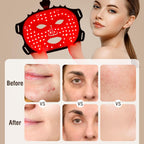 Aurenza Shop The Face Mask Light Therapy Gen.2 showing a sleek black facial mask with LED lights for skin treatment