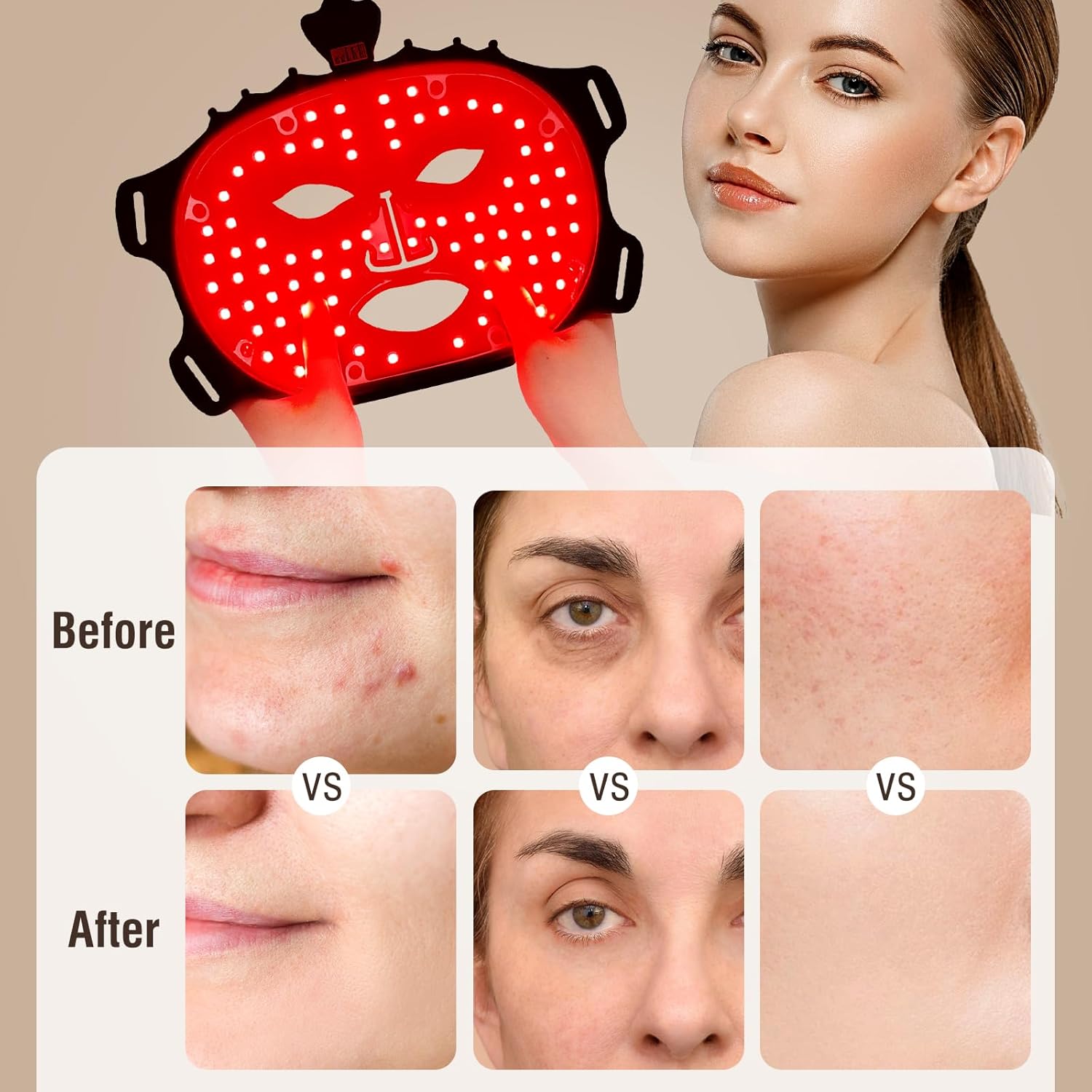 Aurenza Shop The Face Mask Light Therapy Gen.2 showing a sleek black facial mask with LED lights for skin treatment