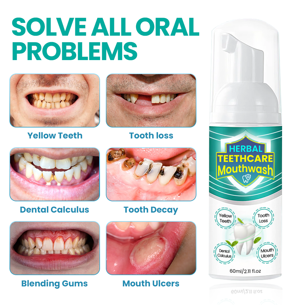 Aurenza Herbal TeethCare Mouthwash bottle with green and white label, showcasing natural ingredients for oral health.