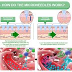 A Wimaid® 10-in-1 nano microneedle patch by Aurenza Shop, featuring a science-backed formula for skin rejuvenation.