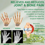 Aurenza Bee Venom Joint and Bone Therapy Advanced Cream jar with label, natural skincare for joint and bone relief.