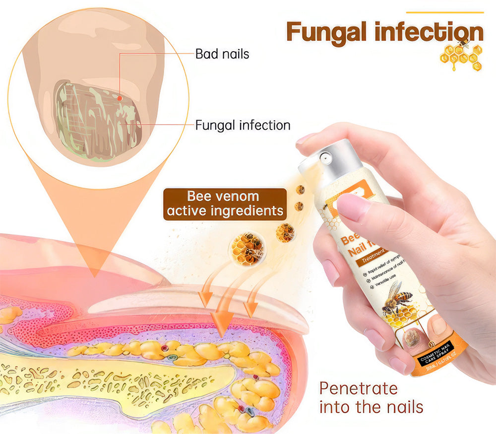 Aurenza Shop Unpree™ Kolirin Bee Venom Nail Fungus Spray applying to toenail with damaged nails, in a beauty and health setting.