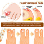 Unpree™ Kolirin Bee Venom Nail Fungus Spray by Aurenza Shop, close-up of the spray bottle for nail fungus treatment and nail health.