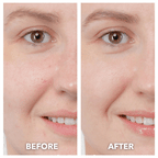 Aurenza ThermaLift 5-in-1 facial sculptor and cleanser device with multiple attachments for skincare and facial contouring.