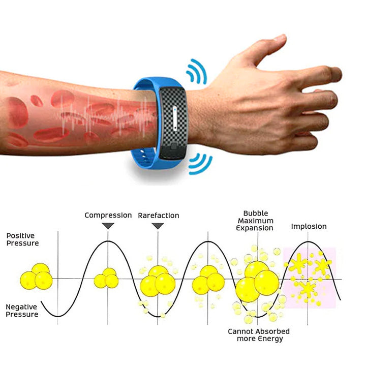 Aurenza Shop WIMAID Matteo Ultrasonic Body Shape Wristband Pro for body contouring and slimming, shown on a model's wrist.