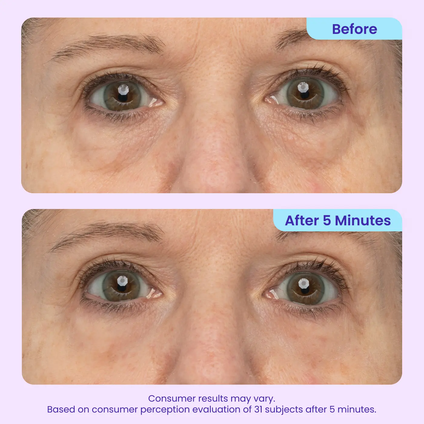 Aurenza Shop WIMAID eye cream jar for erasing eye bags and refreshing eyes instantly, with a sleek white container and a silver lid.