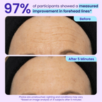 Aurenza Shop WIMAID eye cream applying on under-eye area to reduce puffiness and refresh tired eyes instantly.