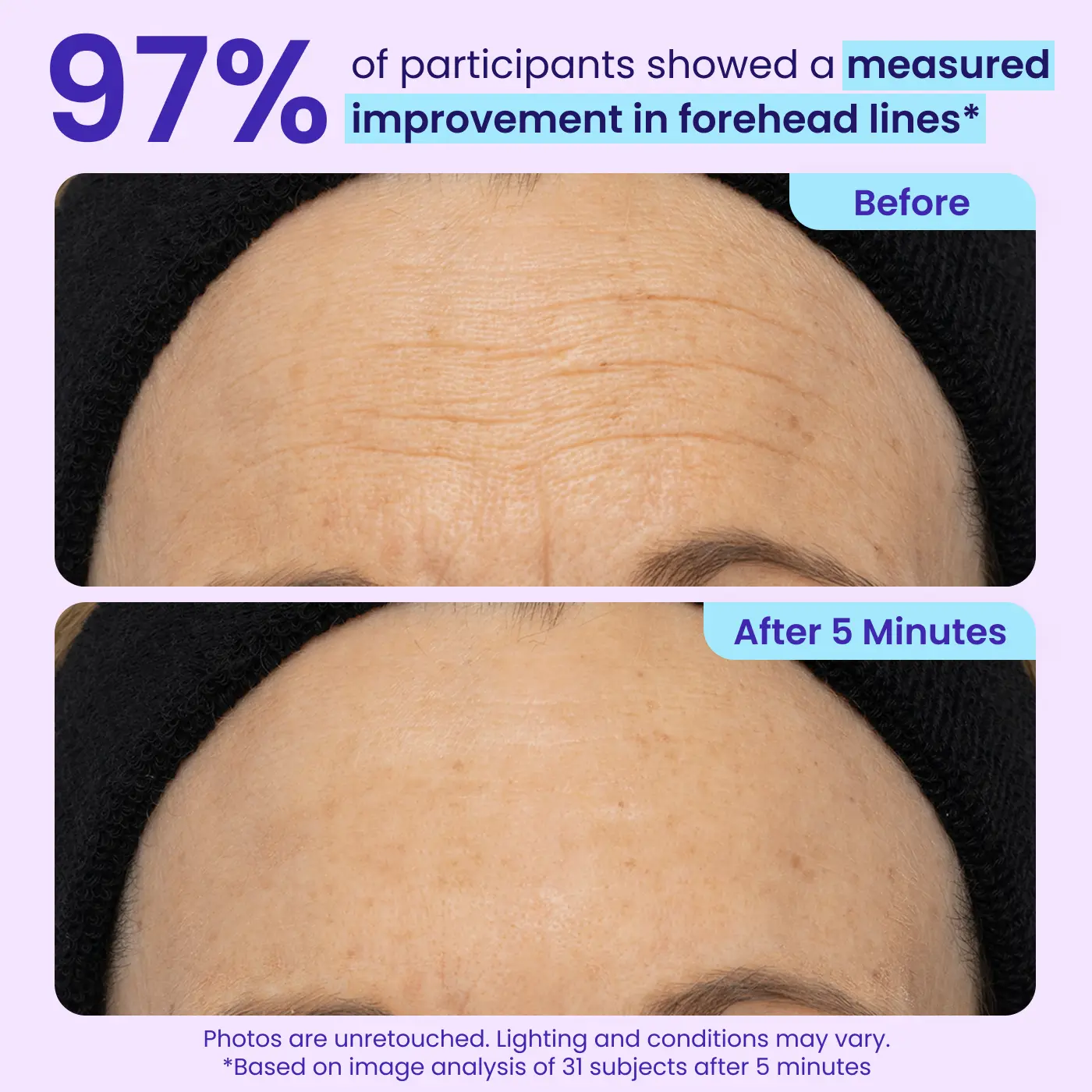 Aurenza Shop WIMAID eye cream applying on under-eye area to reduce puffiness and refresh tired eyes instantly.