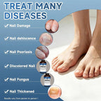 Aurenza Shop Extra Strength Nail Fungus Treatment with triple action formula repairing thick, yellow, damaged nails.
