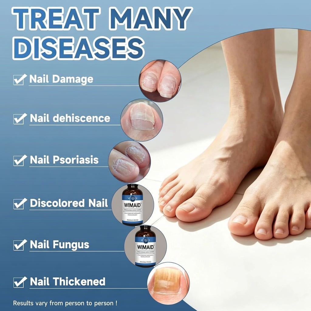 Aurenza Shop Extra Strength Nail Fungus Treatment with triple action formula repairing thick, yellow, damaged nails.