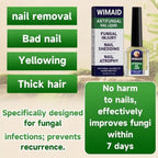 Aurenza Shop extra strength nail fungus treatment bottle showing the product label for repairing thick, yellow, and damaged nails.