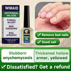 Aurenza Shop extra strength nail fungus treatment bottle with triple action formula for repairing thick, yellow, damaged nails.