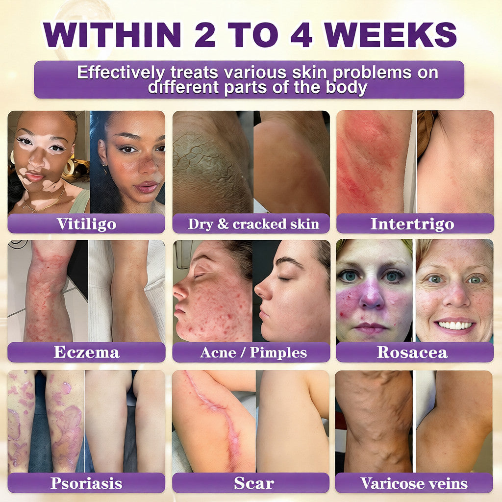 Aurenza Shop WIMAID Biotin 10-in-1 skin restoration cream jar, made in USA, with a white and gold label, close-up view.