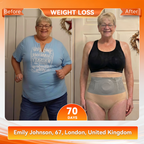 Aurenza Shop WIMAID 2026 Moringa and Biberine 4-in-1 micro-particle sculpting and fat-burning shorts, shown in the product image.