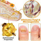 Aurenza Shop UNPREE™ Kolirin Bee Venom Nail Fungus Treatment cream jar with label, designed for nail fungus care.