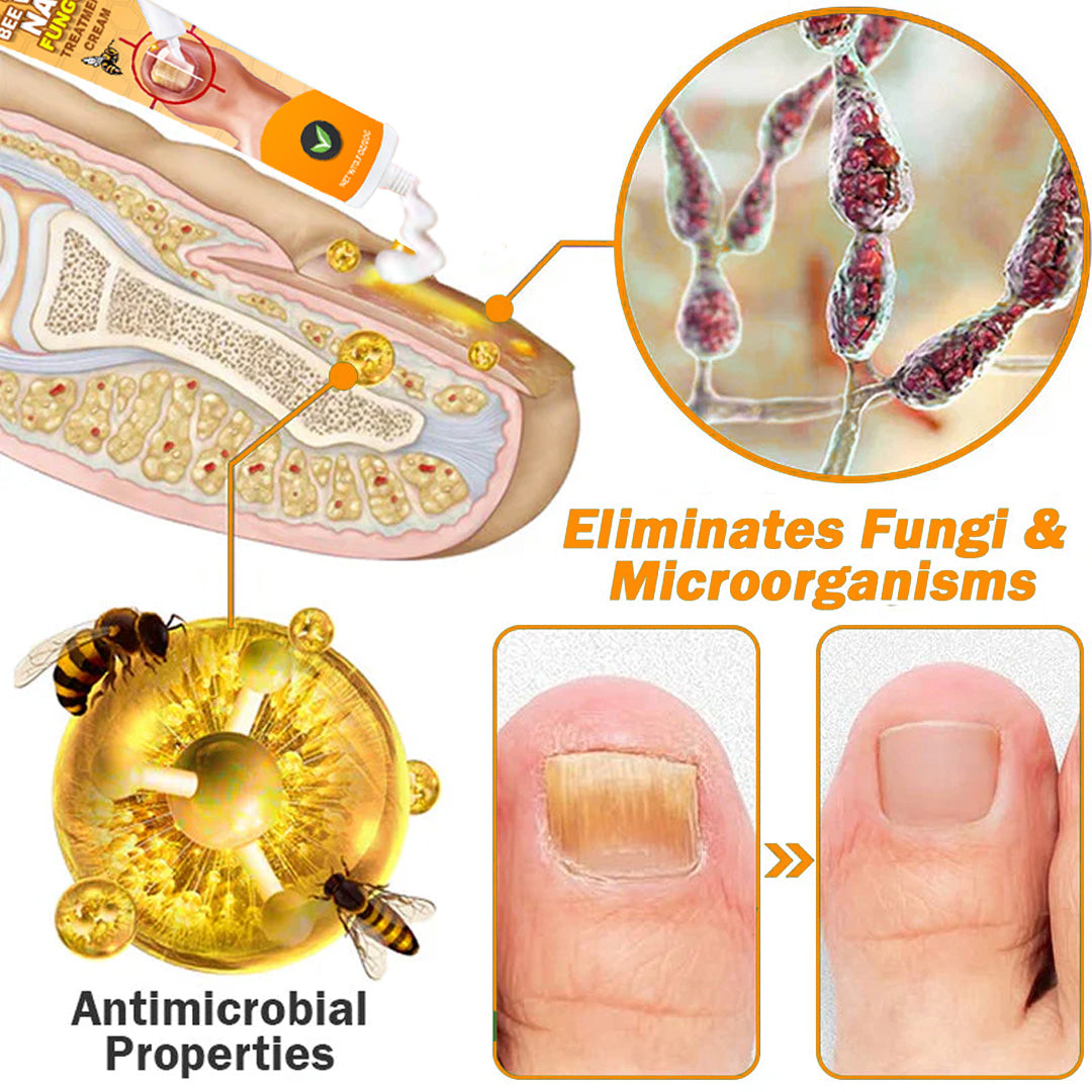 Aurenza Shop UNPREE™ Kolirin Bee Venom Nail Fungus Treatment cream jar with label, designed for nail fungus care.