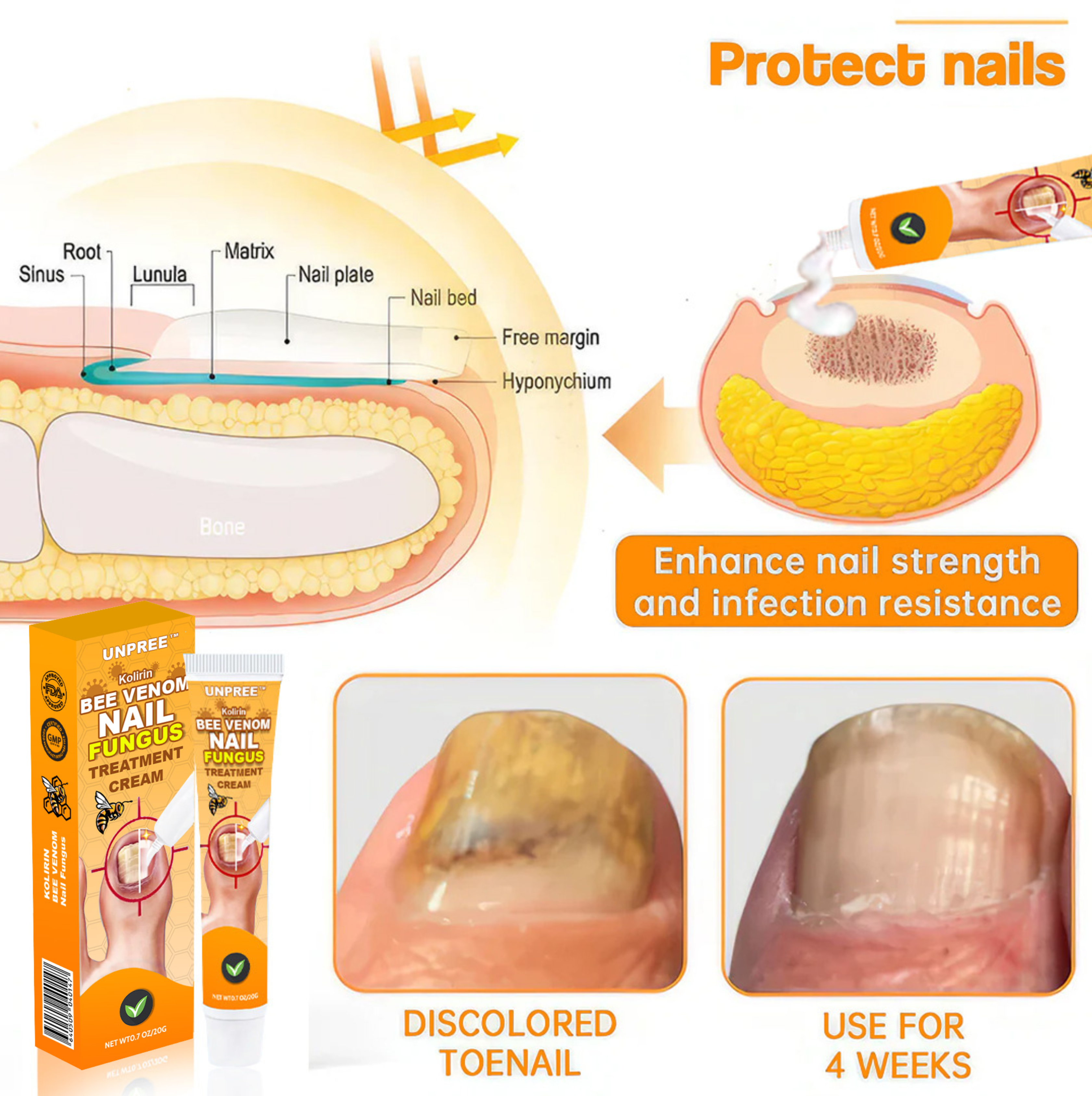 Aurenza Shop UNPREE™ Kolirin bee venom nail fungus treatment cream jar with label and applicator, designed for fungal nail care.