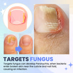 Aurenza Shop SUPTRUCK™ Nail Fungus LED Light Therapy Device for treating nail fungus with a sleek, modern design.
