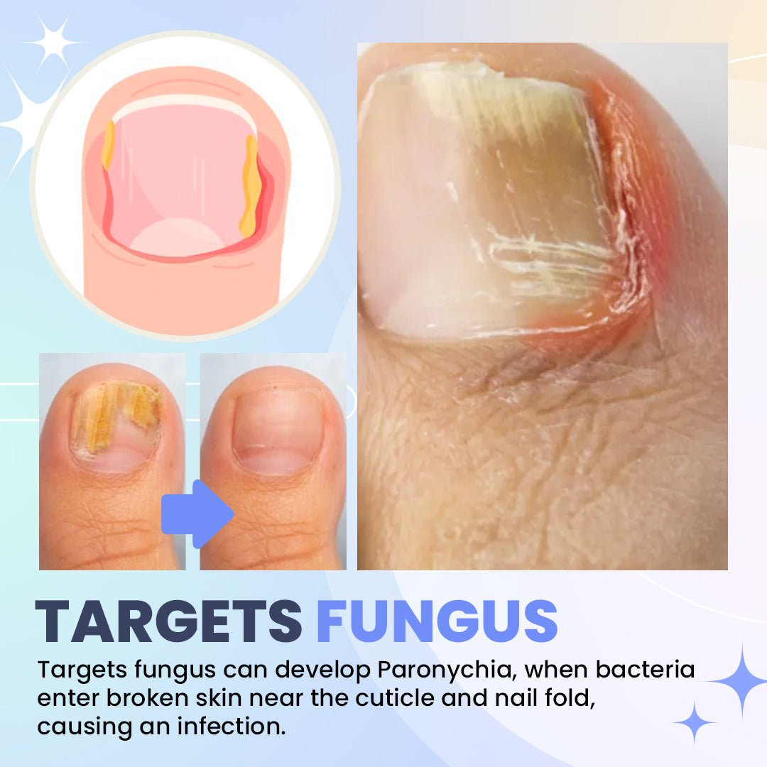 Aurenza Shop SUPTRUCK™ Nail Fungus LED Light Therapy Device for treating nail fungus with a sleek, modern design.
