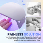 Aurenza Shop SUPTRUCK™ Nail Fungus LED Light Therapy Device used for treating nail fungus with a compact, professional design.
