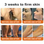 Aurenza Bee Venom Firming Stick, a natural skincare product with bee venom for skin firming and anti-aging benefits.