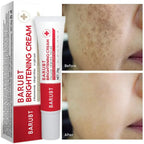 Aurenza Dark Spot & Freckle Corrector face cream with Niacinamide and Vitamin C, showing the jar and product label.