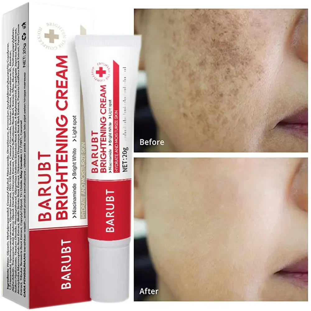 Aurenza Dark Spot & Freckle Corrector face cream with Niacinamide and Vitamin C, showing the jar and product label.
