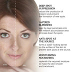 Aurenza Shop dark spot and freckle corrector face cream with niacinamide and vitamin C, showing the cream jar with label.