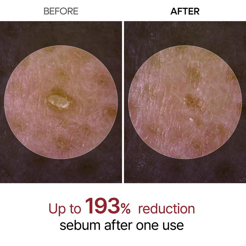 Dr.Melaxin Peel Shot Glow Rice Ampoule Duo by Aurenza Shop, featuring black and white ampoules for skin renewal and radiance.