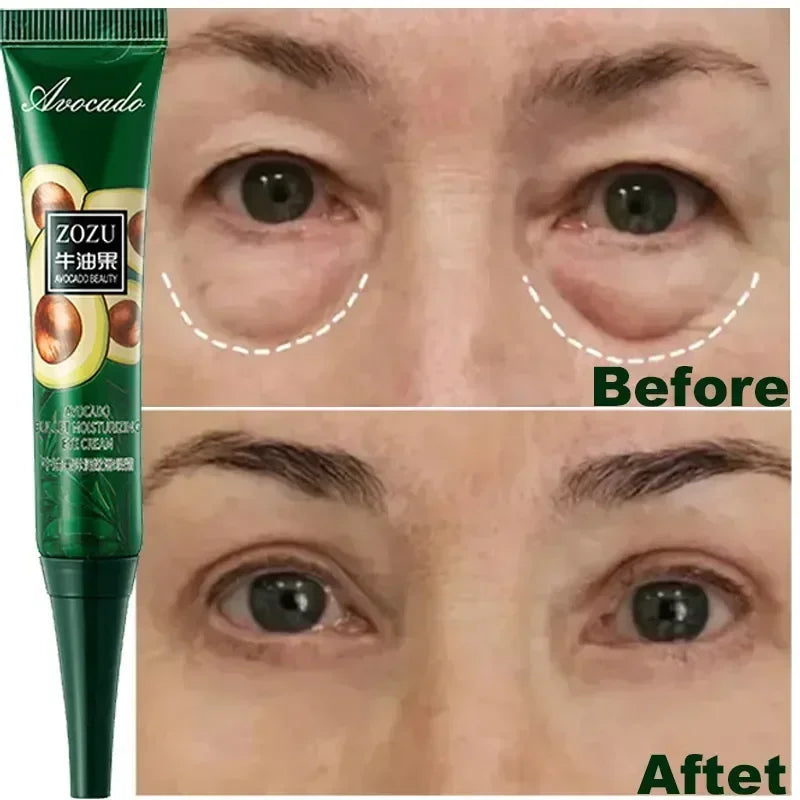Aurenza Shop Instant Remove Wrinkles Eye Cream with applicator, targeting dark circles, puffiness, and fine lines around the eyes.