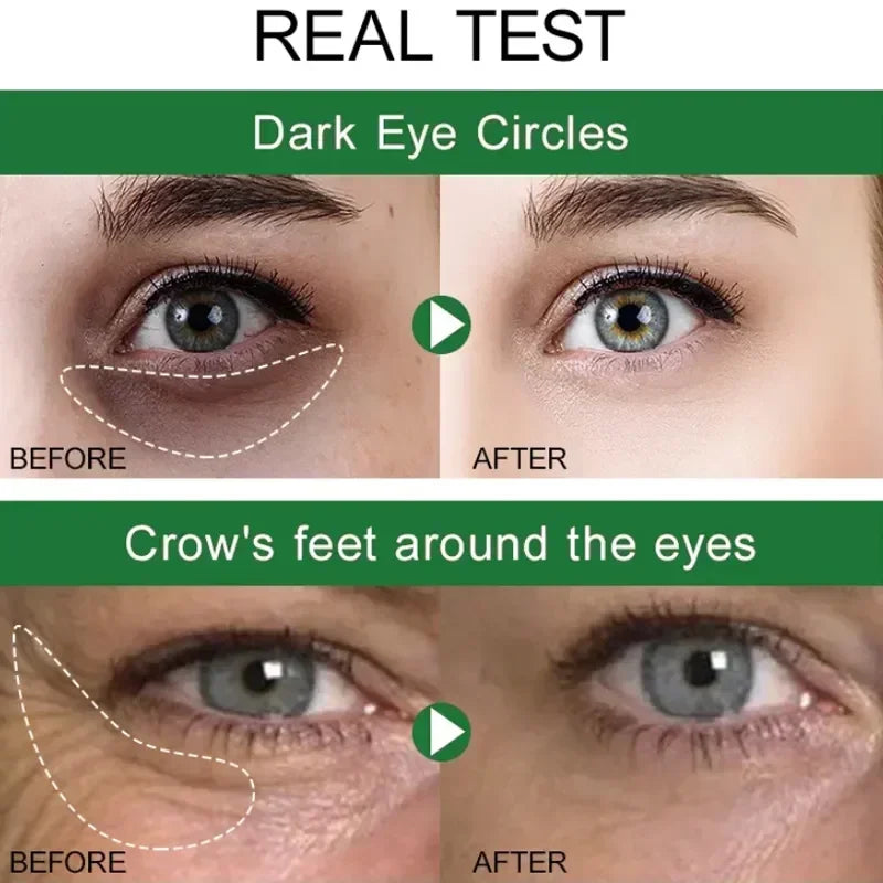 Aurenza Shop Instant Remove Wrinkles Eye Cream with applicator, showing the cream and packaging for anti-aging and dark circle treatment.