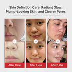 Medicube AGE-R Booster-H K-beauty glow booster device with sleek design and digital display for skin rejuvenation.