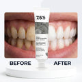 Aurenza Shop natural toothpaste for sensitive teeth, showing a tube of Rebuild Your Enamel in 7 Days with gentle, effective whitening.