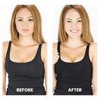 Aurenza Shop ShapeSecure™ Double-Sided Boost Pads showing before and after images of enhanced breast shaping and support.