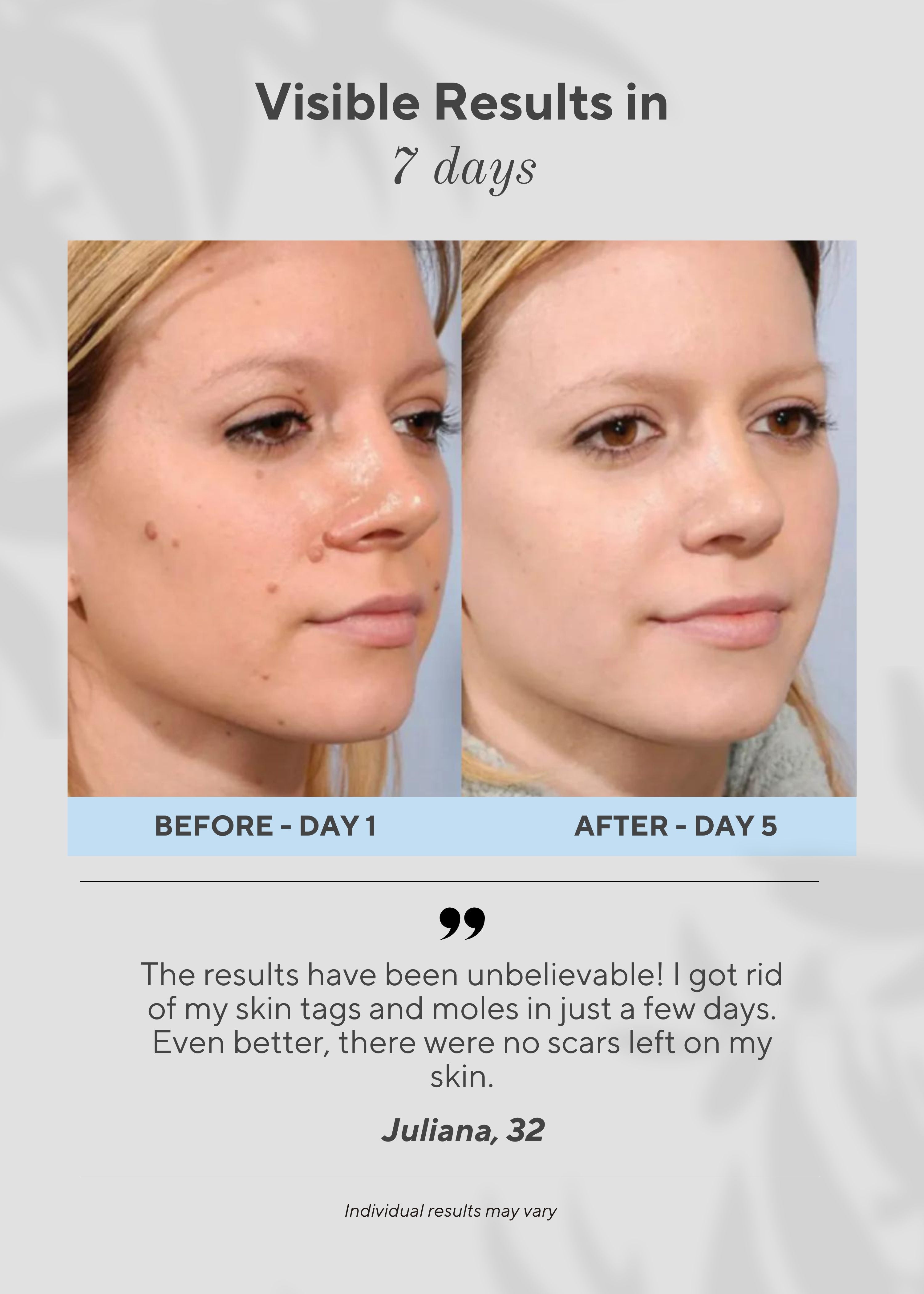 Aurenza Shop 6-in-1 Skin Imperfection Removal Pen showing multiple treatment heads for skincare and blemish removal.