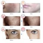 Aurenza Shop Kahuna Red Therapy Facial Mask massager with textured surface for skin rejuvenation and relaxation.