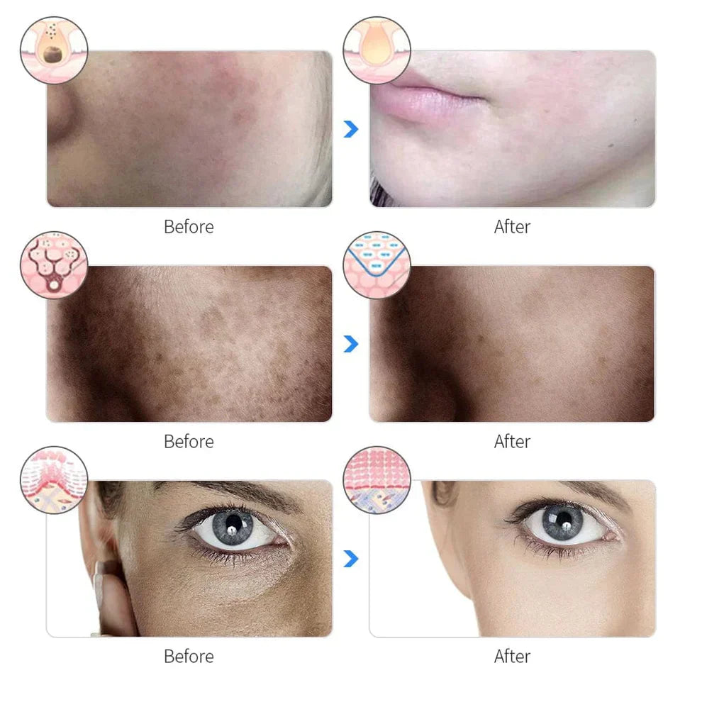 Aurenza Shop Kahuna Red Therapy Facial Mask massager with textured surface for skin rejuvenation and relaxation.