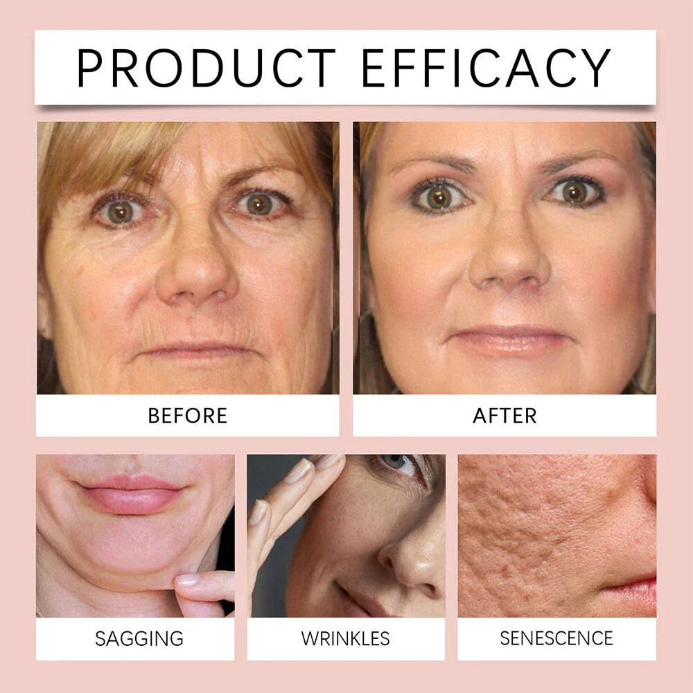 Serenzza Collagen Overnight Peel-Off Facial Mask with deep hydration and skin renewal, showing the mask applied on a woman's face.