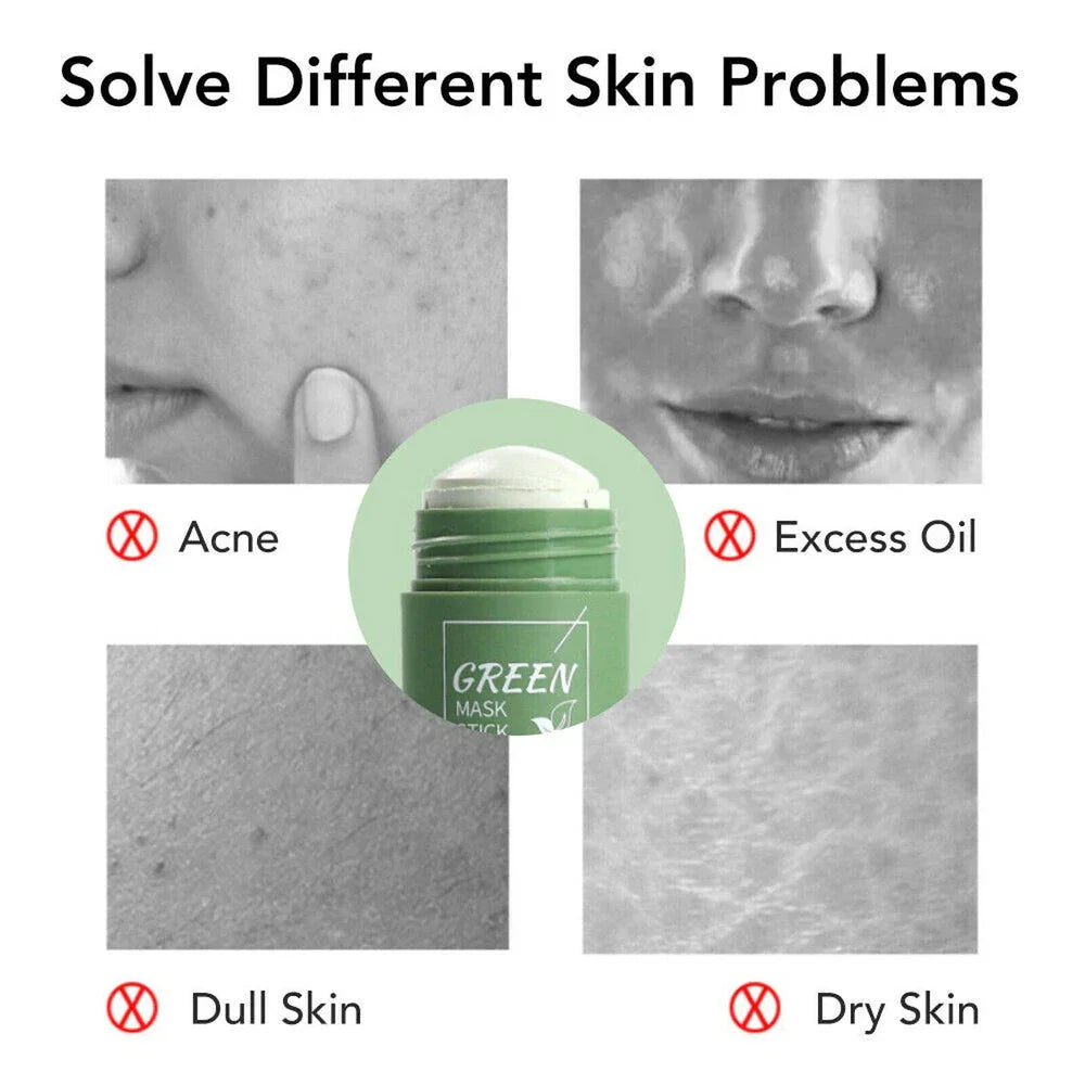 Serenzza green clay face mask stick for deep cleansing, blackhead removal, and pore purifying on a clean skin surface.